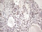 TP53BP1 Antibody in Immunohistochemistry (Paraffin) (IHC (P))