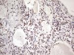 TP53BP1 Antibody in Immunohistochemistry (Paraffin) (IHC (P))