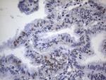 TP53BP1 Antibody in Immunohistochemistry (Paraffin) (IHC (P))