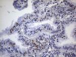 TP53BP1 Antibody in Immunohistochemistry (Paraffin) (IHC (P))