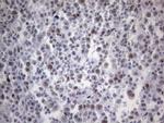 TP53BP1 Antibody in Immunohistochemistry (Paraffin) (IHC (P))