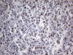 TP53BP1 Antibody in Immunohistochemistry (Paraffin) (IHC (P))