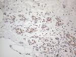 TP53BP1 Antibody in Immunohistochemistry (Paraffin) (IHC (P))