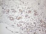 TP53BP1 Antibody in Immunohistochemistry (Paraffin) (IHC (P))