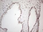 TP53BP1 Antibody in Immunohistochemistry (Paraffin) (IHC (P))