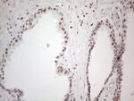 TP53BP1 Antibody in Immunohistochemistry (Paraffin) (IHC (P))