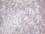 TP53BP1 Antibody in Immunohistochemistry (Paraffin) (IHC (P))
