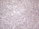 TP53BP1 Antibody in Immunohistochemistry (Paraffin) (IHC (P))