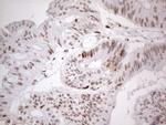 TP53BP1 Antibody in Immunohistochemistry (Paraffin) (IHC (P))