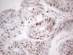 TP53BP1 Antibody in Immunohistochemistry (Paraffin) (IHC (P))
