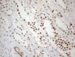 TP53BP1 Antibody in Immunohistochemistry (Paraffin) (IHC (P))