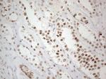 TP53BP1 Antibody in Immunohistochemistry (Paraffin) (IHC (P))