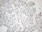 TP53BP1 Antibody in Immunohistochemistry (Paraffin) (IHC (P))