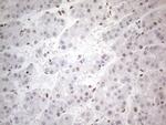 TP53BP1 Antibody in Immunohistochemistry (Paraffin) (IHC (P))