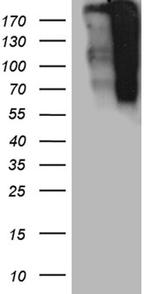 TP53BP1 Antibody in Western Blot (WB)