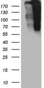 TP53BP1 Antibody in Western Blot (WB)