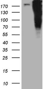 TP53BP1 Antibody in Western Blot (WB)