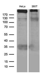 TP53BP1 Antibody in Western Blot (WB)