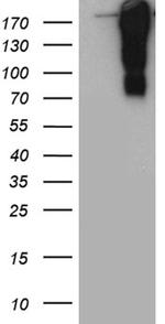 TP53BP1 Antibody in Western Blot (WB)