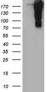 TP53BP1 Antibody in Western Blot (WB)