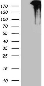 TP53BP1 Antibody in Western Blot (WB)