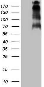 TP53BP1 Antibody in Western Blot (WB)