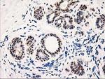 TP53I3 Antibody in Immunohistochemistry (Paraffin) (IHC (P))