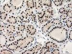TP53I3 Antibody in Immunohistochemistry (Paraffin) (IHC (P))