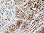 TP53I3 Antibody in Immunohistochemistry (Paraffin) (IHC (P))