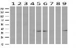 TP53I3 Antibody in Western Blot (WB)