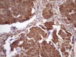 TP53RK Antibody in Immunohistochemistry (Paraffin) (IHC (P))