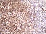 TP53RK Antibody in Immunohistochemistry (Paraffin) (IHC (P))