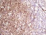 TP53RK Antibody in Immunohistochemistry (Paraffin) (IHC (P))
