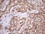 TP53RK Antibody in Immunohistochemistry (Paraffin) (IHC (P))