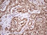 TP53RK Antibody in Immunohistochemistry (Paraffin) (IHC (P))