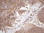 TP53RK Antibody in Immunohistochemistry (Paraffin) (IHC (P))