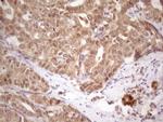 TP53RK Antibody in Immunohistochemistry (Paraffin) (IHC (P))