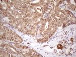 TP53RK Antibody in Immunohistochemistry (Paraffin) (IHC (P))
