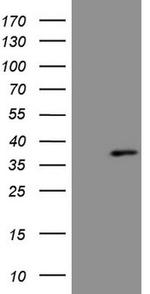 TP53RK Antibody in Western Blot (WB)