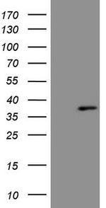 TP53RK Antibody in Western Blot (WB)