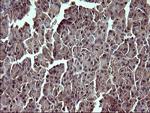 TP73 Antibody in Immunohistochemistry (Paraffin) (IHC (P))