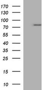 TP73 Antibody in Western Blot (WB)