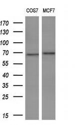 TP73 Antibody in Western Blot (WB)