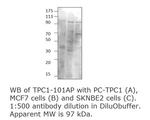 TPCN1 Polyclonal Antibody