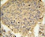 TRAPPC6A Antibody in Immunohistochemistry (IHC)