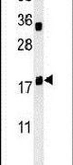 TRAPPC6A Antibody in Western Blot (WB)