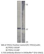 Prlz/TPD52 Polyclonal Antibody
