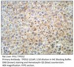 Prlz/TPD52 Polyclonal Antibody