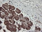 TPD52L3 Antibody in Immunohistochemistry (Paraffin) (IHC (P))