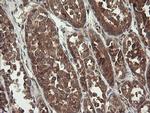 TPD52L3 Antibody in Immunohistochemistry (Paraffin) (IHC (P))